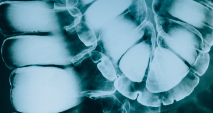 Burps, Bottoms and Bile